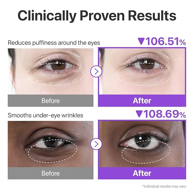 Numbuzin No.9 NAD+ Collagen Under Eye Patches — 5 Pairs