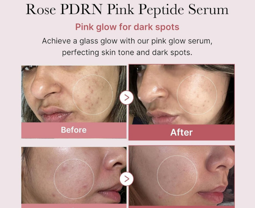 Medicube PDRN Peptide Serum