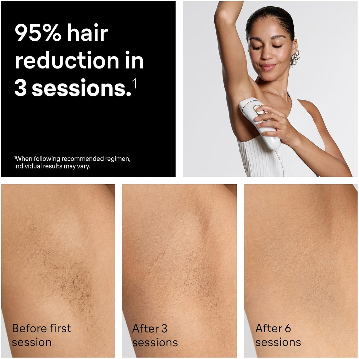 Braun IPL Silk-expert Pro 5 Hair Removal