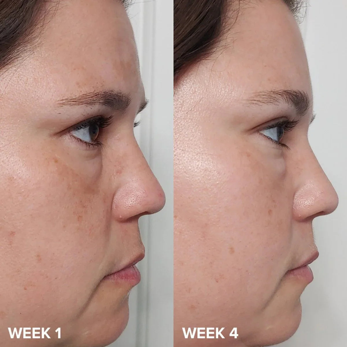 Paula’s Choice Skin Perfecting 2% BHA Liquid Exfoliant