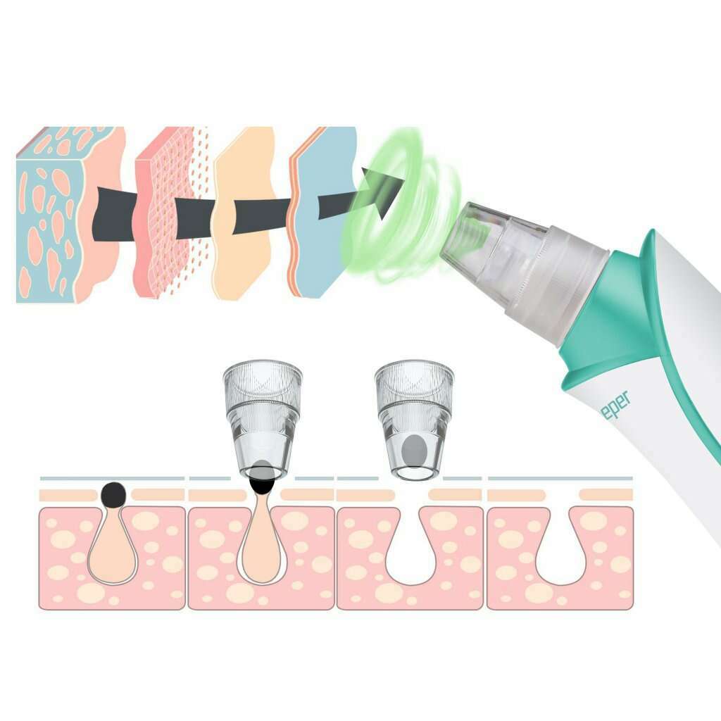 Rechargeable Pore Vacuum And Black Head Remover Skin Cleansing Brushes & Systems Rechargeable Pore Vacuum And Black Head Remover Rechargeable Pore Vacuum And Black Head Remover Beper