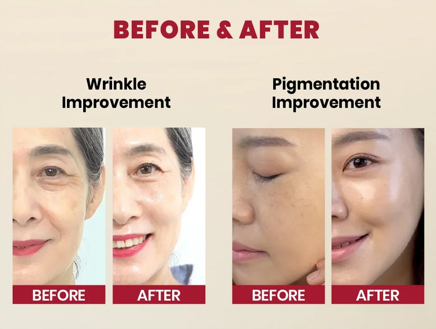 Seoul 1988 Retinal Liposome 2% + Black Ginseng Serum